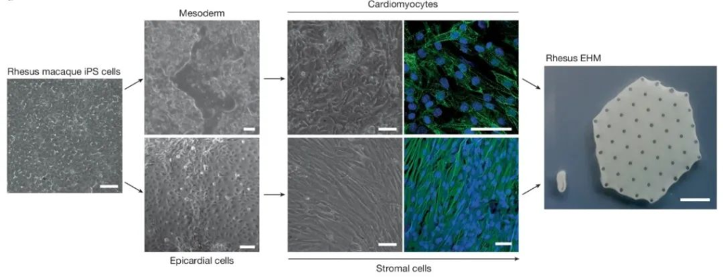 《《自然》：“补心”贴片来了！科学家发明干细胞工程心肌，补强衰竭心脏的受损结构和功能丨科学大发现》